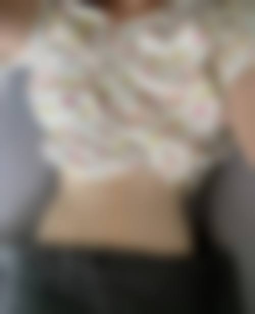 总结:常州娜媄整形医院罗远亮排第几?选对医生与医院的关键