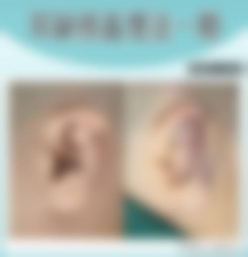 北京外耳再造术国内排医生院该如何选择？