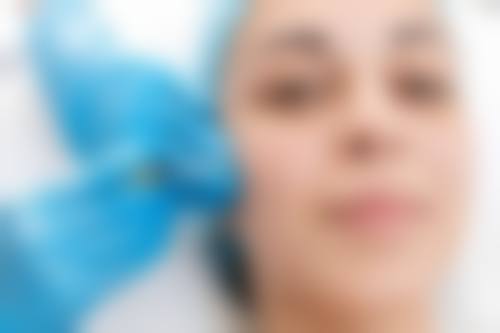 除了填充，这些方法也能救你的眼袋切除凹陷