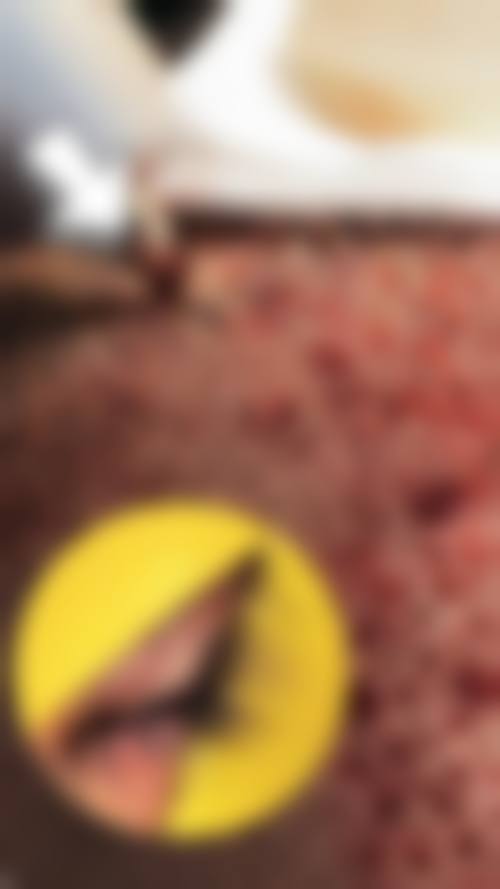 毛发种植效果能维持多久？一般可长久维持，这与毛囊特性、术后护理等密切相关！植发10 - 20年不是梦，选对医院技术+做好术后护理是关键 