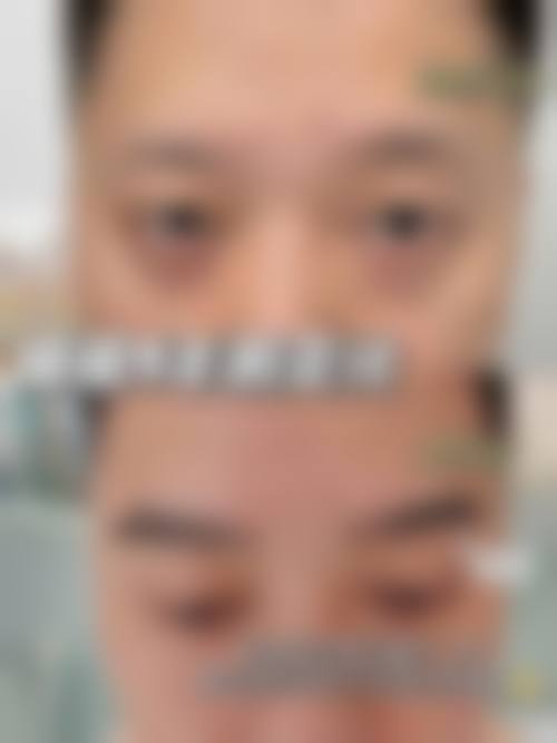 哪些人群在评估中更可能被建议考虑毛发种植？