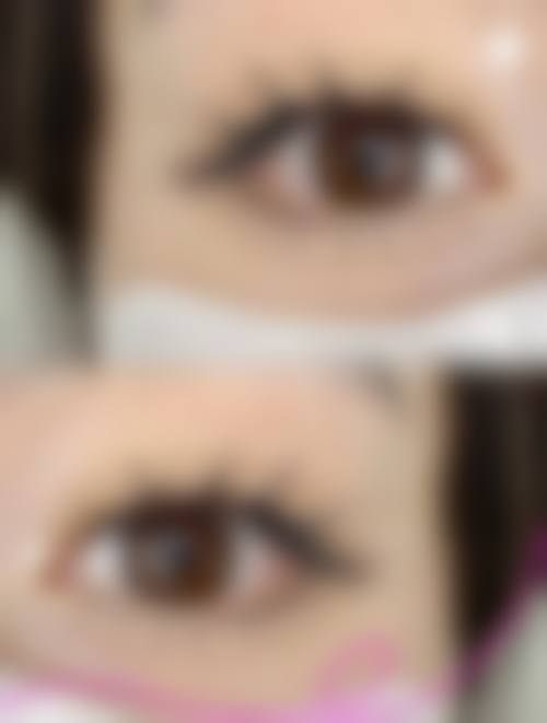 九、围绕种植头发，临床中更常见的并发问题有哪些？