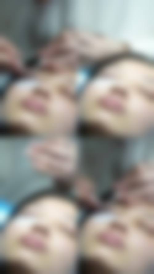 在决定是否选择毛发种植前，普通用户更容易忽略的关键评估点及医院医生推荐