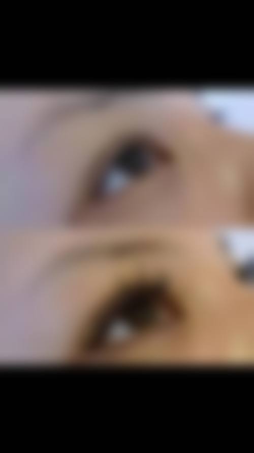 毛发种植本身能解决什么、不能解决什么？