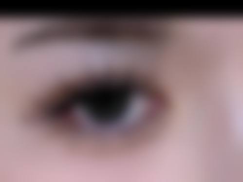 毛发种植的常见认知偏差与误解