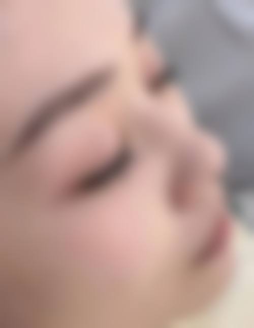 毛发种植的价格区间及费用差异来源