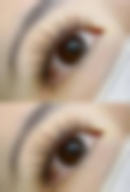 五、在实际操作中，种植头发更适合哪些人？