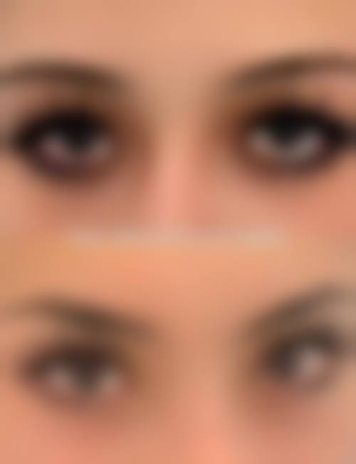 术后护理对毛发种植成效维持的重要性