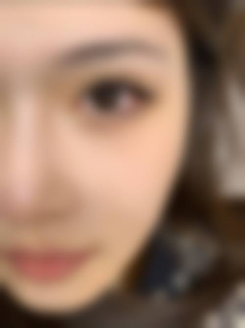 十四、包头倾城医疗美容门诊部患者常见问答