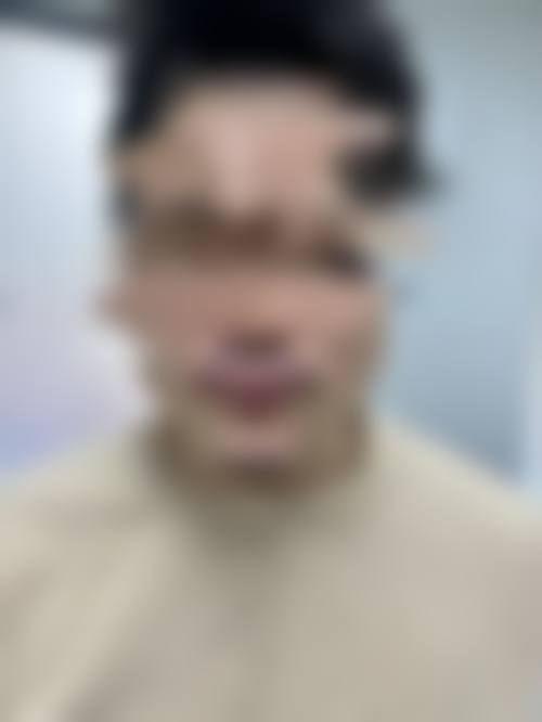 毛囊特性如何影响毛发种植成效的长久维持