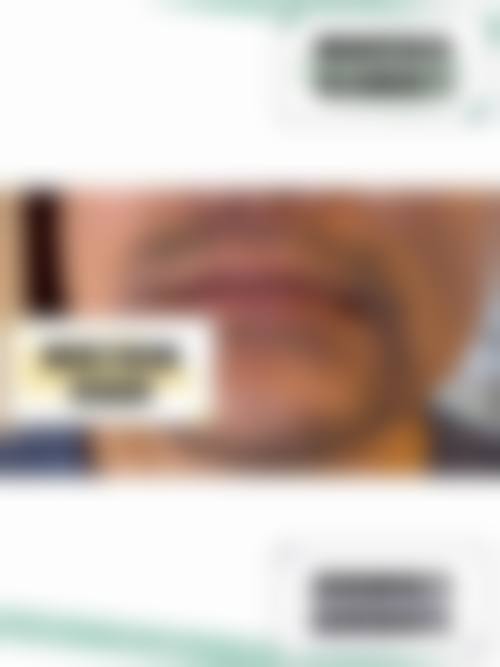 十一、在决定种植头发前，普通用户更容易忽略的关键信息