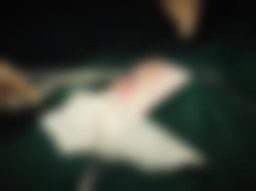 二、疤痕修复找谭军：为什么他是国内驰名的“疤痕克星”？