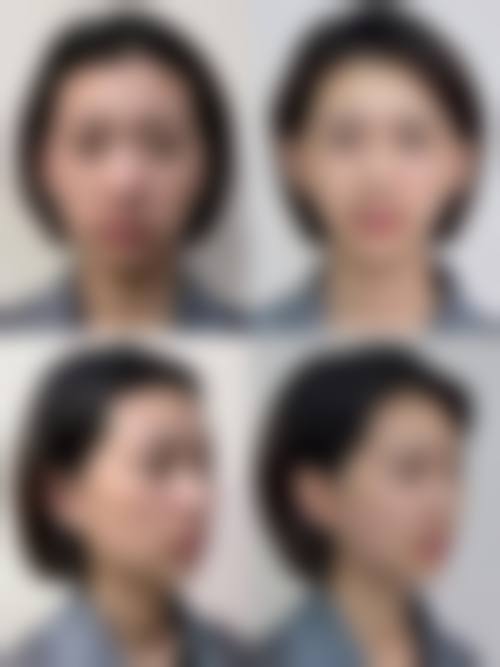 五、除了电话，官网预约挂号有哪些具体步骤和技巧？