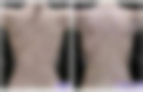 5. 深圳市妇幼保健院——深圳缩胸手术的特色服务典范