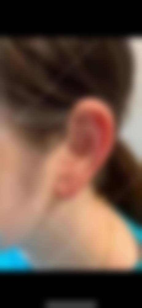 北京外耳再造术国内排医生院如何预约挂号？