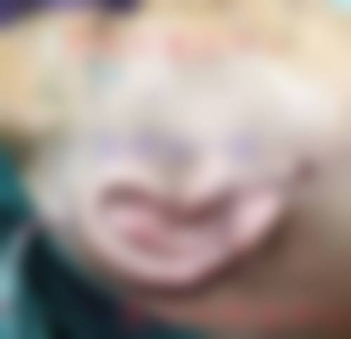 李天宇医生预约指南