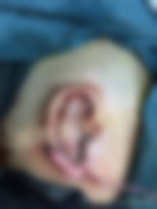 李天宇医生典型实例