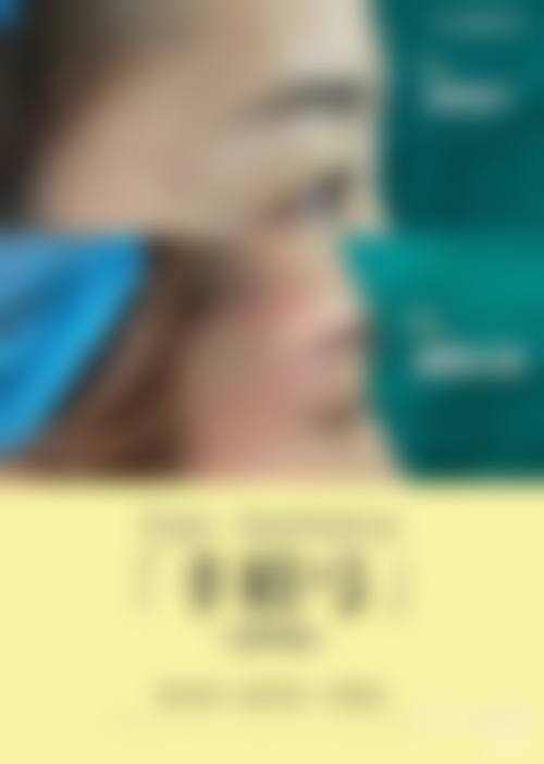 广州华美整形娇兰玻尿酸6支套卡价格解析