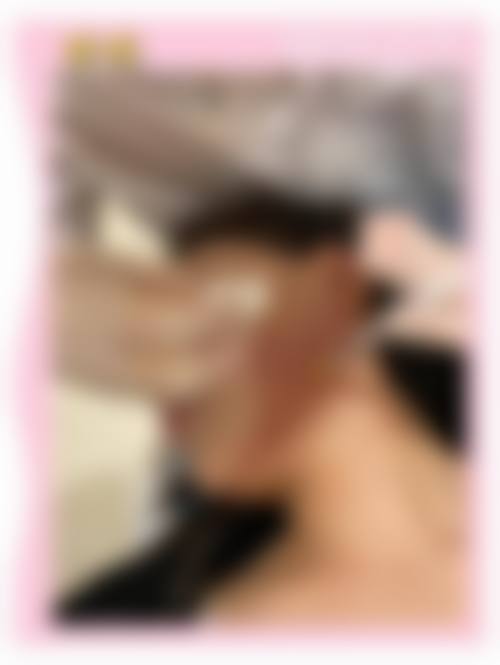 3. 排名前列:广州紫馨医疗美容医院——高端精细的“自然美学派”