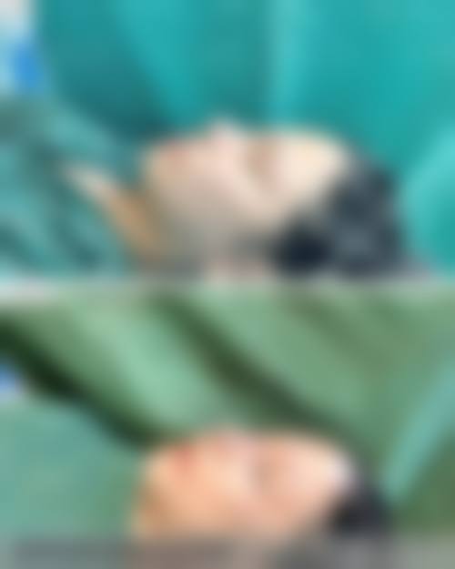 七、包头倾城医疗美容门诊部特色项目技术怎么样