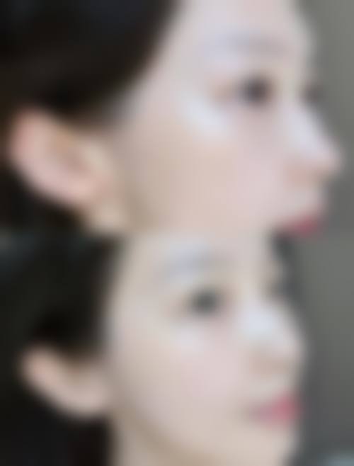 骨干医生实例多到看花眼？揭秘上海华美医疗美容医院骨干医生团队实力！