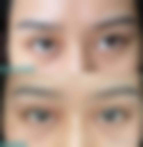 ✅韩国胸部整形医院排名：除优雅人外，韩国md整形外科也是热门之选