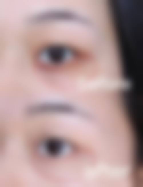 广州韩妃整形医院娇兰玻尿酸价格明细