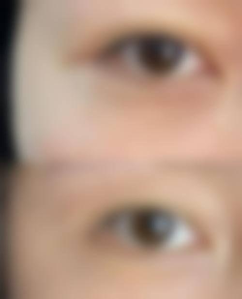 杭州天鑫医疗整形正规吗？