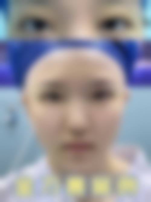 杭州天鑫医疗美容医院位置在哪？拱墅区余杭塘路456号，地铁5号线直达，专业医美团队等你来变美！