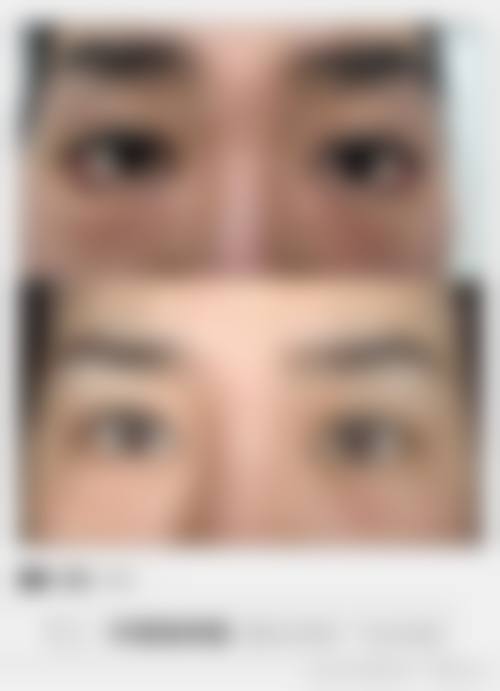 杭州天鑫医疗美容医院的手术成效如何？