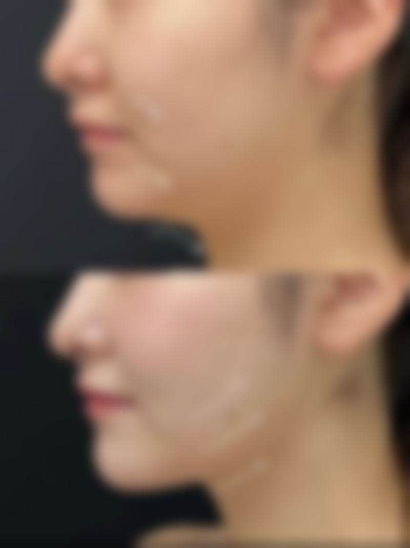 7、蚌埠蚌山区人民医院价格表/收费区间参考