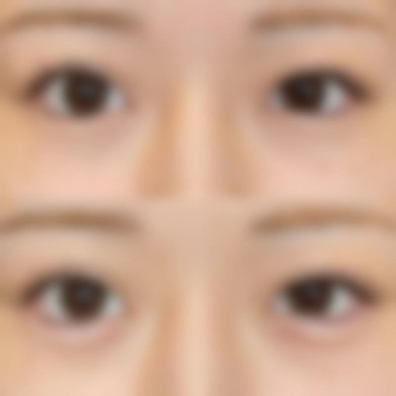 二、杭州连天美:杭州初家5 a级医美资质,合规性拉满