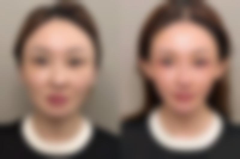 六、第一次面诊需要准备什么?给医美小白的超全攻略