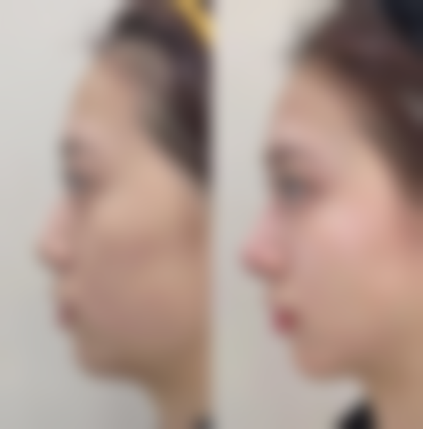 2. 河南郑州集美美容医院——汇聚中外骨干医生的整形殿堂