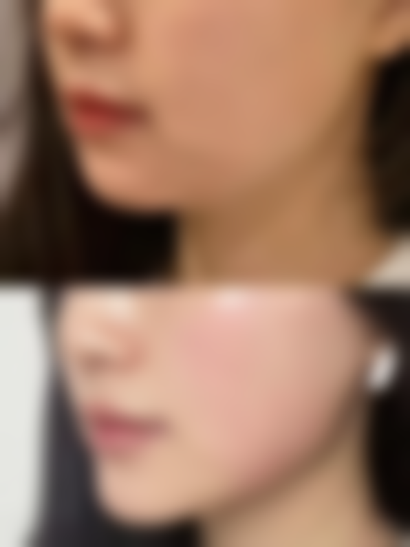 二、 纠结终结者：罗志军 医生的双眼皮 vs 伍晓云医生的祛斑，怎么选？