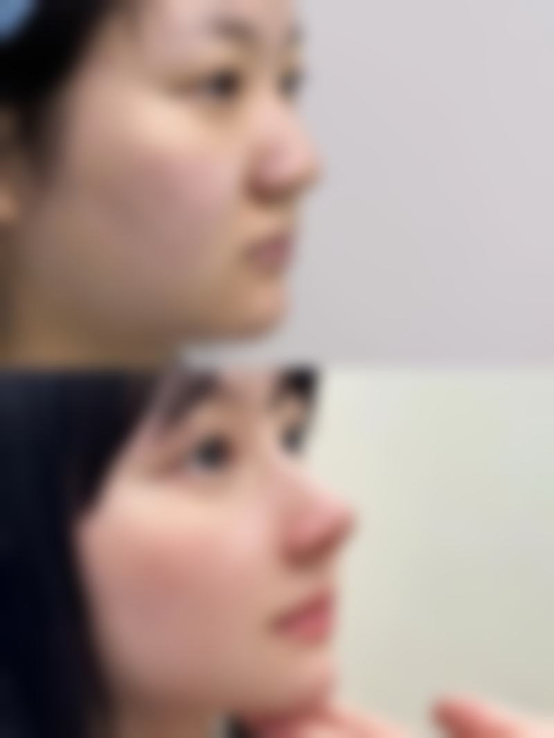 沈阳北方整形医院怎么样?精良设备+个性化方案打造自然成效