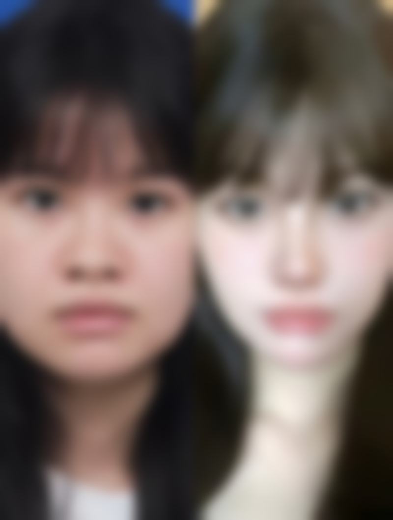 三、高正君医生坐诊，究竟擅长哪些“容貌加分”项目？