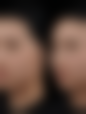 四、在甘肃省人民医院整形科做项目，成效和安心性如何保护？