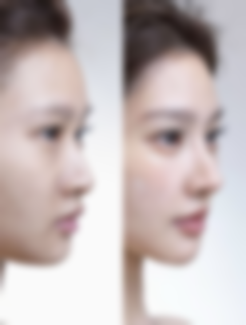 二、三等甲医院技术到底有多靠谱?揭秘深圳市三院整形科的硬核实力!