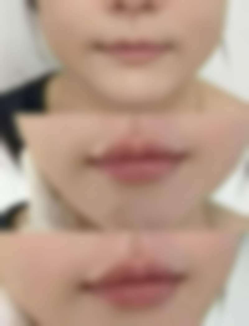 五、张思娅医生口碑和评价