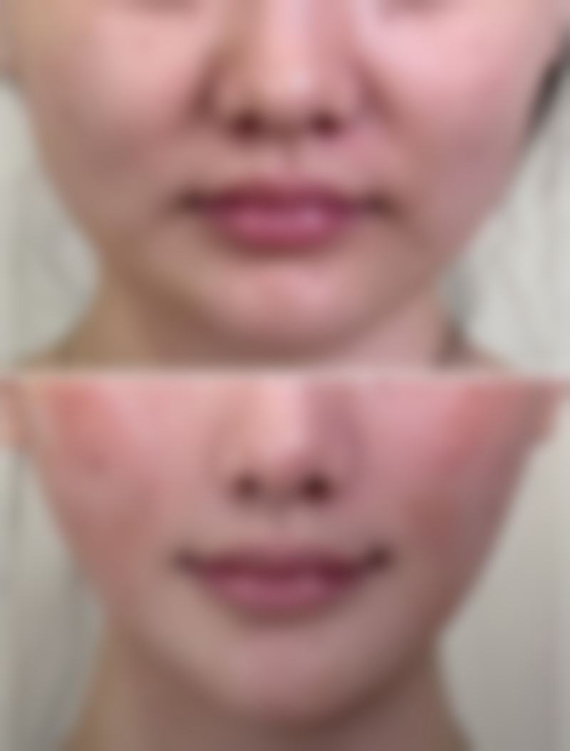 六、上海九院整形科有哪些项目？从眼鼻到轮廓全都有！