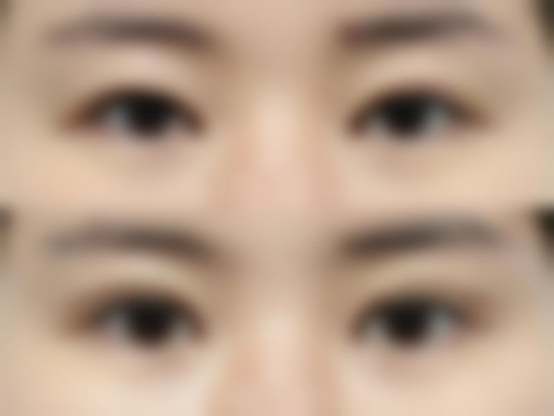 深圳哪个整形医院口碑更好?三线机构真实评价来了!