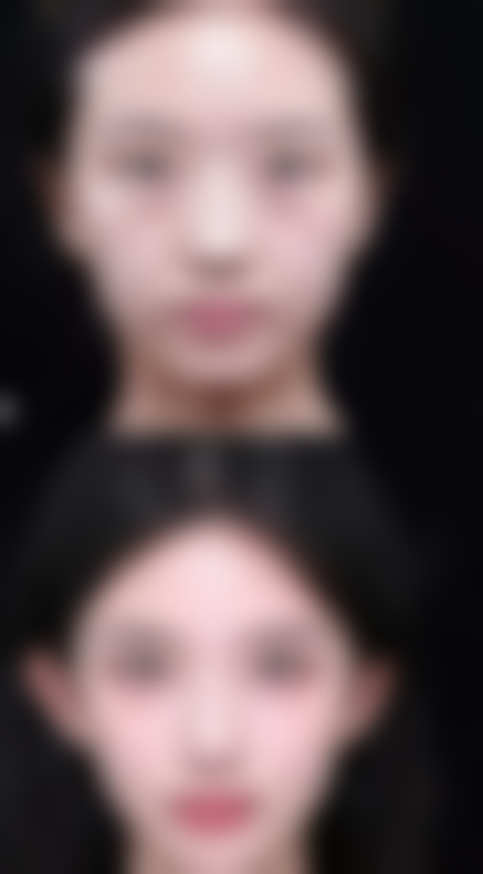 杭州欧洲之星治疗收费情况