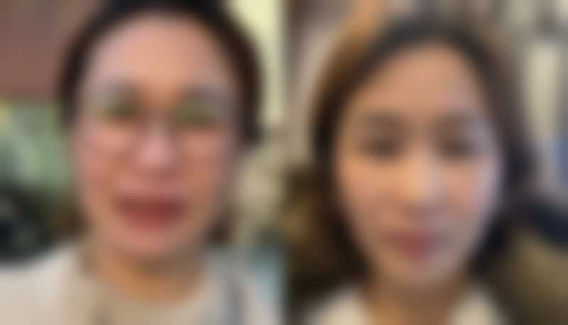 五、郑州玻尿酸额头去皱医院哪家好选择指南