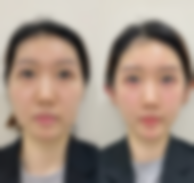 六、想了解价格？湖南省人民医院整形美容收费贵吗？