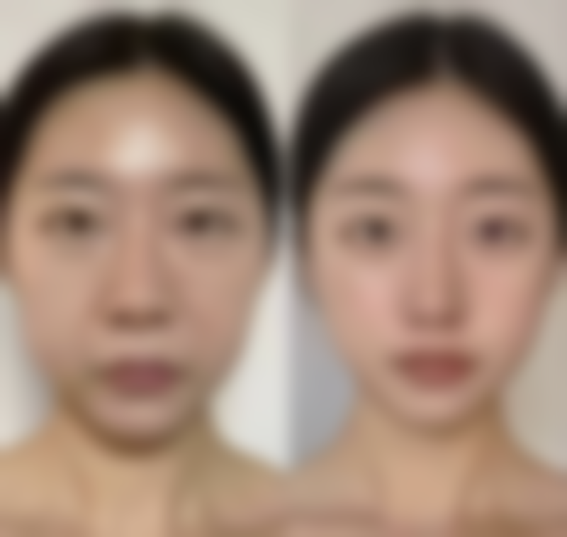 太原疗美项疗项疗项