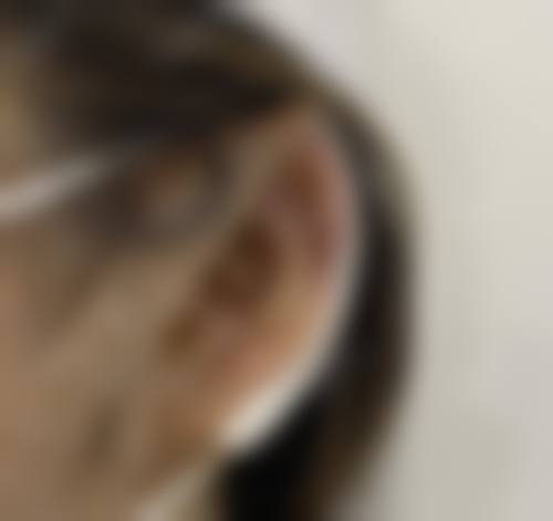 成都慕臻颜医疗美容门诊部口碑如何