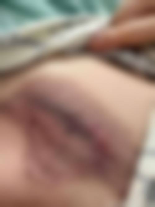 十一、海口聚美辰赫辰医疗美容医院口碑和评价