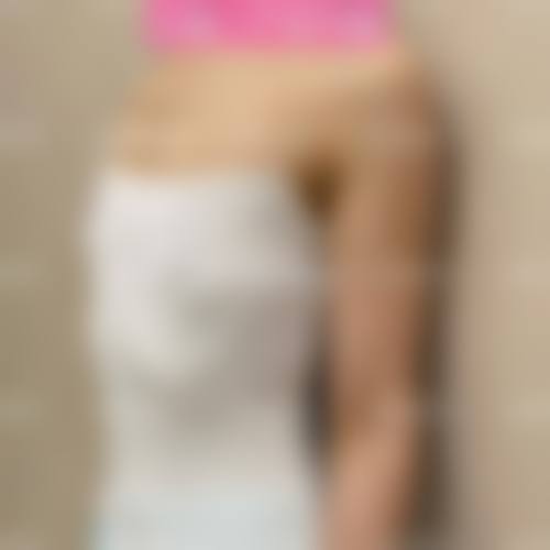 南阳美丽之星医疗美容门诊部毛发种植技术优势