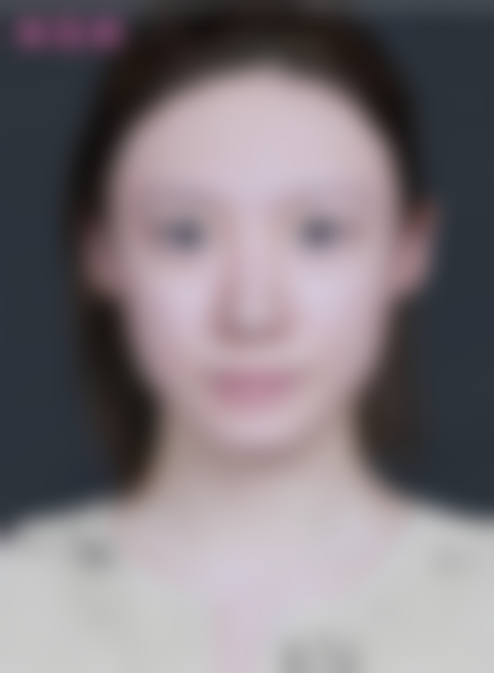 精细操作如何实现?林莉医生揭秘“毫米级”手术细节!